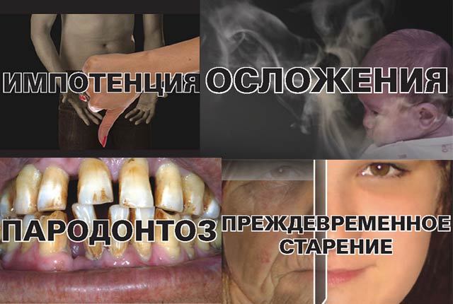 New Day: In Russia messaggi positivi sui pacchetti di sigarette invece di immagini spaventose
