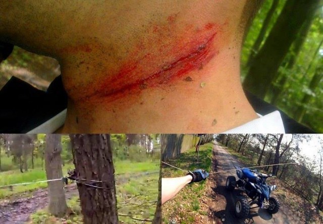New Day: Un motociclista quasi decapitato dal filo spinato teso dai teppisti