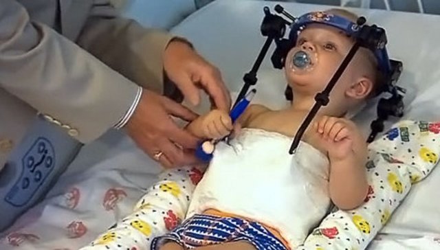 New Day: Australia, chirurghi hanno salvato la vita del bambino decapitato in un incidente stradale (FOTO)