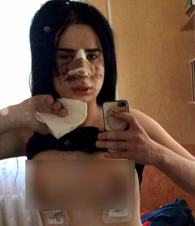 New Day: In Dagestan ucciso brutalmente transgender che aveva cambiato sesso (FOTO)