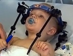 Australia, chirurghi hanno salvato la vita del bambino decapitato in un incidente stradale (FOTO)
