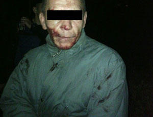 In Ucraina un uomo uccide un cane e beve il suo sangue (FOTO 18+) / Il vampiro è stato arrestato