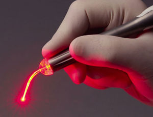 Scienziati russi creano laser chirurgico ad alta precisione